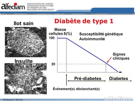 Diabète de type 1 Ilot sain Insulite Pré-diabetes Diabetes