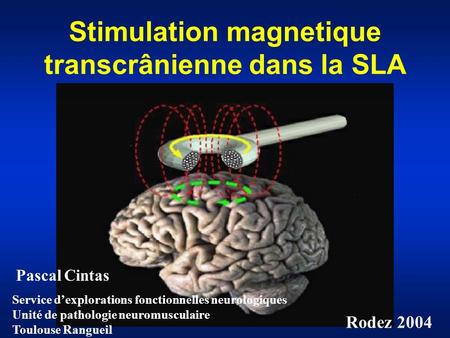 Stimulation magnetique transcrânienne dans la SLA