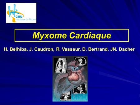 Myxome Cardiaque H. Belhiba, J. Caudron, R. Vasseur, D. Bertrand, JN. Dacher.