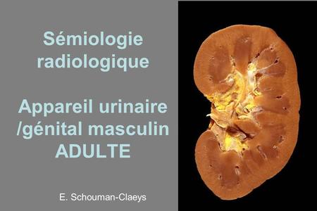 Sémiologie radiologique Appareil urinaire /génital masculin ADULTE