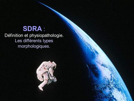 SDRA : Définition et physiopathologie