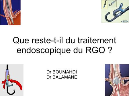 Que reste-t-il du traitement endoscopique du RGO ?