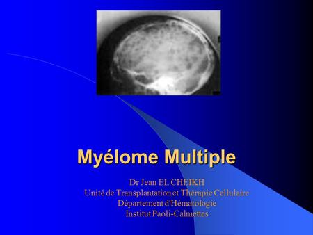 Myélome Multiple Dr Jean EL CHEIKH