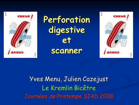 Perforation digestive et scanner Yves Menu, Julien Cazejust Le Kremlin Bicêtre Journées de Printemps SIAD 2008.