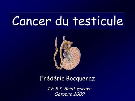 Cancer du testicule Frédéric Bocqueraz I.F.S.I. Saint-Egrève