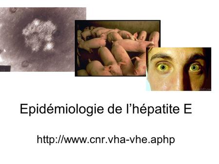 Epidémiologie de l’hépatite E