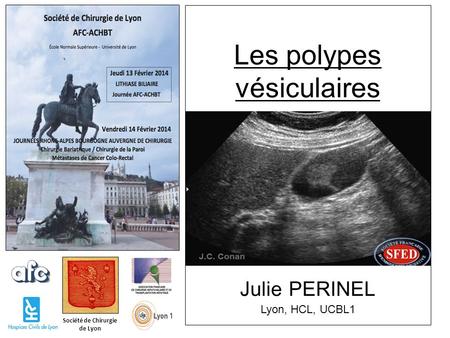 Les polypes vésiculaires Julie PERINEL Lyon, HCL, UCBL1