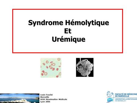 Syndrome Hémolytique Et Urémique