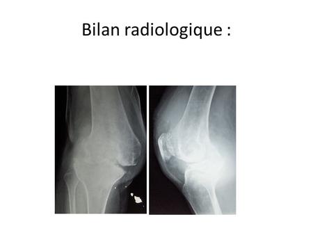 Bilan radiologique :.