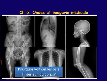 Ch 5: Ondes et imagerie médicale