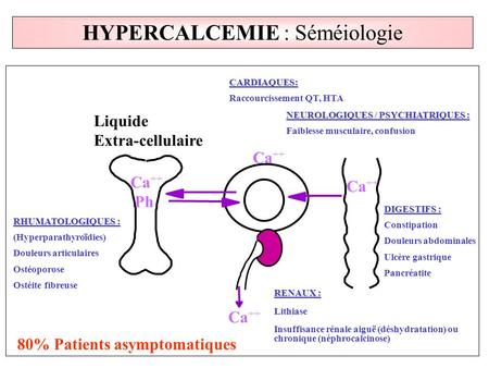 HYPERCALCEMIE : Séméiologie