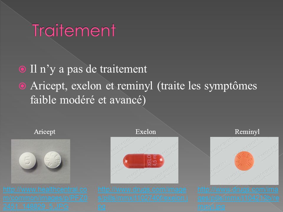 arcoxia 80 mg