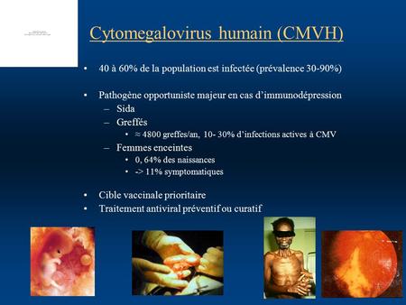 Cytomegalovirus humain (CMVH)