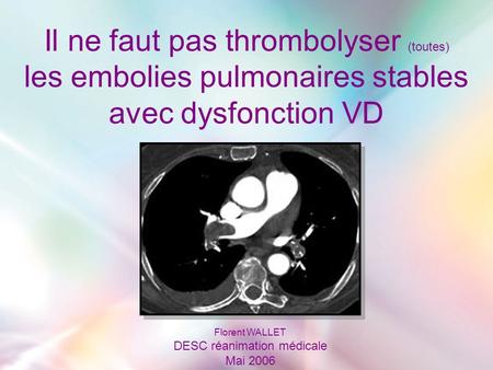 Il ne faut pas thrombolyser (toutes) les embolies pulmonaires stables avec dysfonction VD Florent WALLET DESC réanimation médicale Mai 2006.