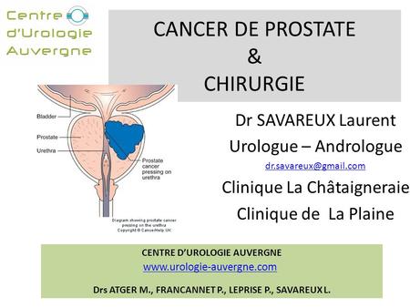 CANCER DE PROSTATE & CHIRURGIE