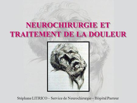 NEUROCHIRURGIE ET TRAITEMENT DE LA DOULEUR