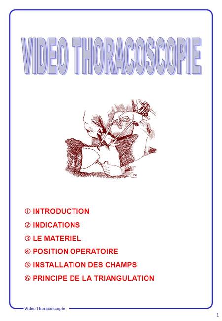 VIDEO THORACOSCOPIE  INTRODUCTION  INDICATIONS  LE MATERIEL
