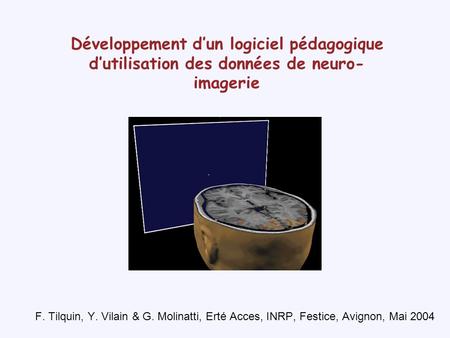 Développement d’un logiciel pédagogique d’utilisation des données de neuro-imagerie F. Tilquin, Y. Vilain & G. Molinatti, Erté Acces, INRP, Festice, Avignon,
