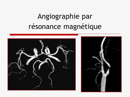 Angiographie par résonance magnétique