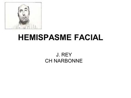 HEMISPASME FACIAL J. REY CH NARBONNE.