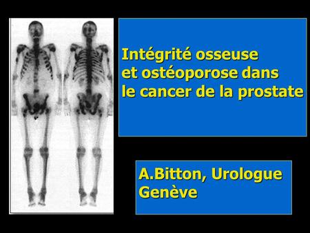 Intégrité osseuse et ostéoporose dans le cancer de la prostate