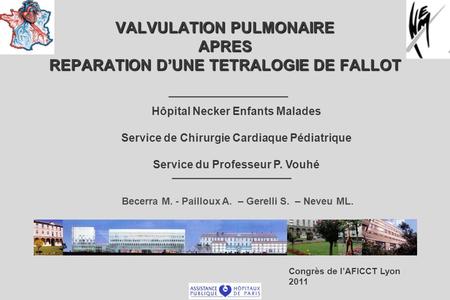 VALVULATION PULMONAIRE APRES REPARATION D’UNE TETRALOGIE DE FALLOT