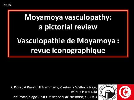 NR26 Moyamoya vasculopathy: a pictorial review Vasculopathie de Moyamoya : revue iconographique C Drissi, A Ramzu, N Hammami, R Sebaï, K Walha, S Nagi,