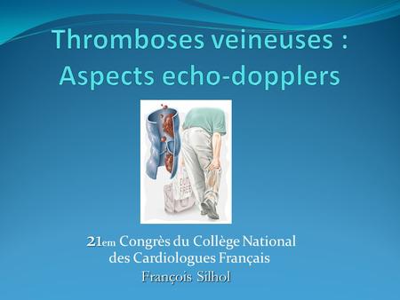 Thromboses veineuses : Aspects echo-dopplers