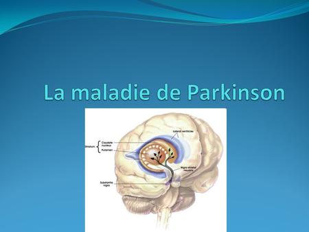Quelques statistiques… Environ 7 à 10 millions individus dans le monde entier vivent avec la maladie de Parkinson 1. Au Canada, près de 100 000 individus.