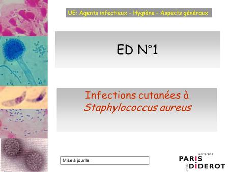 Infections cutanées à Staphylococcus aureus