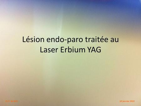Lésion endo-paro traitée au Laser Erbium YAG