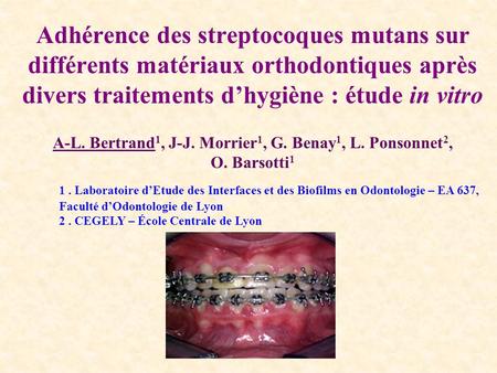 Adhérence des streptocoques mutans sur différents matériaux orthodontiques après divers traitements d’hygiène : étude in vitro A-L. Bertrand1, J-J. Morrier1,