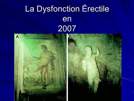 La Dysfonction Érectile en 2007