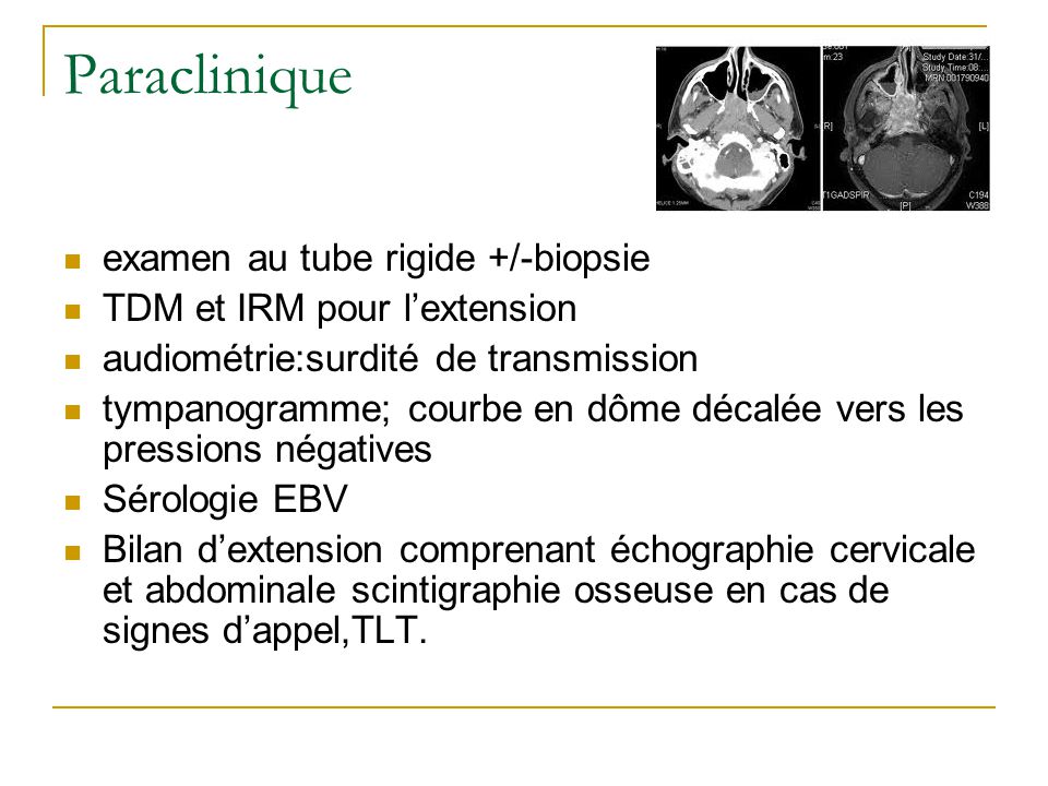 chimiothérapie thérapie ciblée