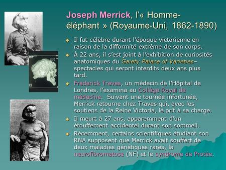 Joseph Merrick, l’« Homme-éléphant » (Royaume-Uni, )