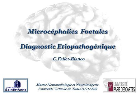 Microcéphalies Foetales Diagnostic Etiopathogénique