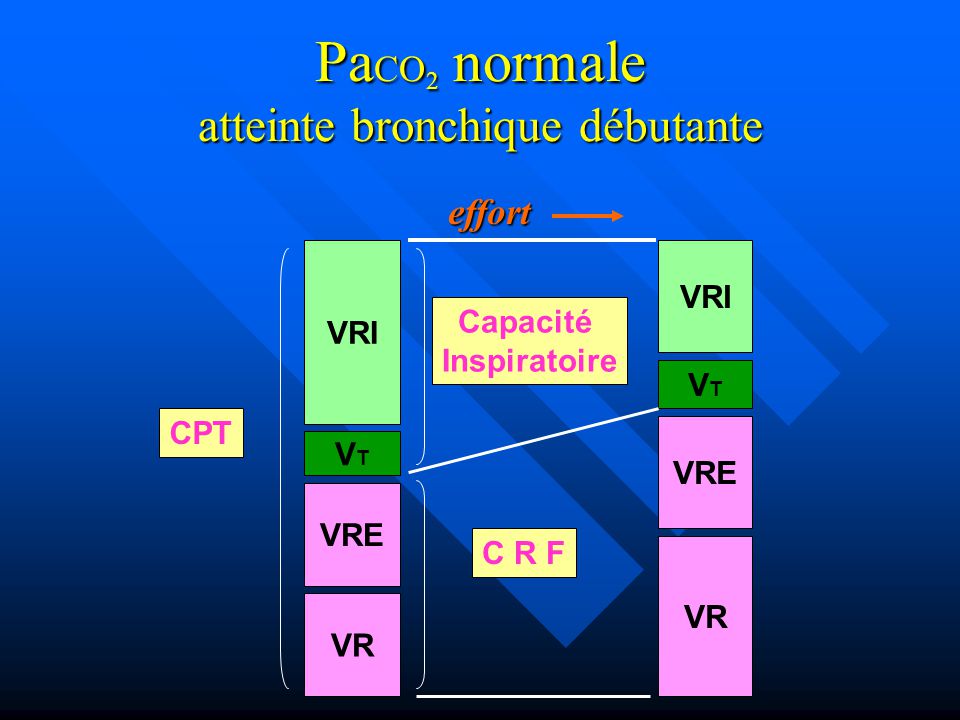 bronchopneumopathie chronique obstructive   d u00e9finition