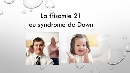 La trisomie 21 ou syndrome de Down