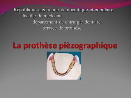 République algérienne démocratique et populaire faculté de médecine département de chirurgie dentaire service de prothèse.
