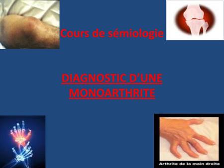 Cours de sémiologie DIAGNOSTIC D’UNE MONOARTHRITE