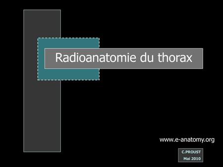 Radioanatomie du thorax