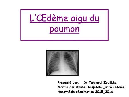 L’Œdème aigu du poumon Présenté par: Dr Tahraoui Zoulikha