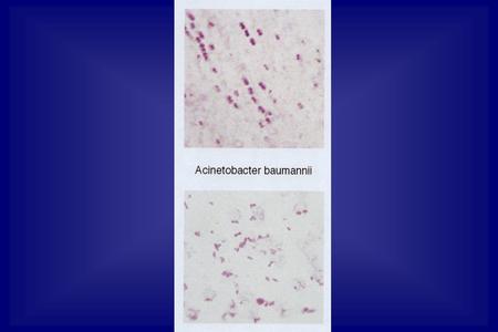 1. 1 Autres bacilles à Gram négatif: les BG (-) aérobies non exigeants 1- Nosocomiaux Pseudomonas sp.; Acinetobacter baumannii; 2- Communautaires.