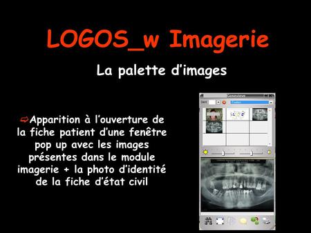 LOGOS_w Imagerie La palette d’images  Apparition à l’ouverture de la fiche patient d’une fenêtre pop up avec les images présentes dans le module imagerie.