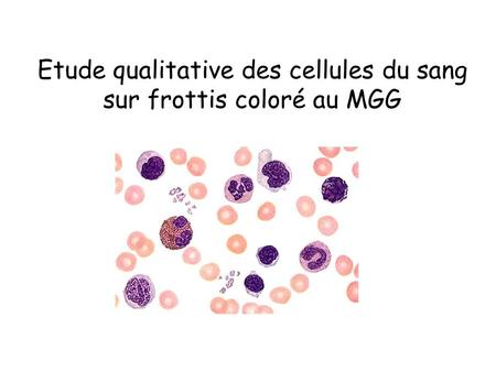 Etude qualitative des cellules du sang sur frottis coloré au MGG