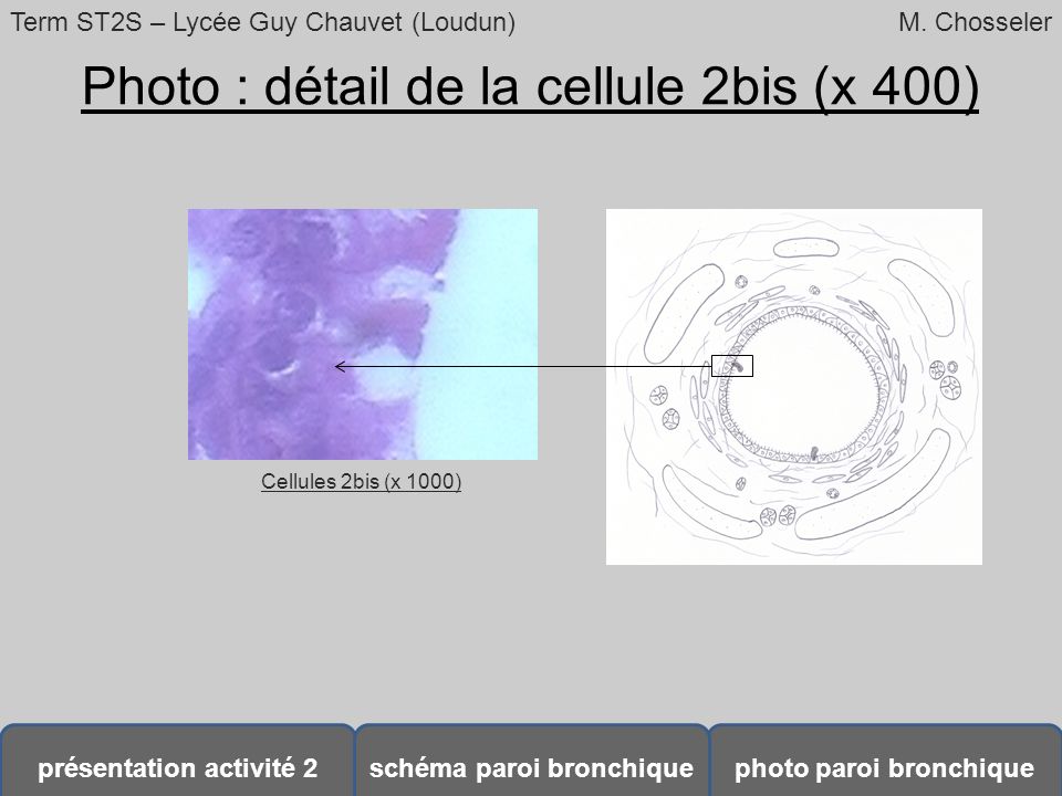 Photo : détail de la cellule 2bis (x 400)