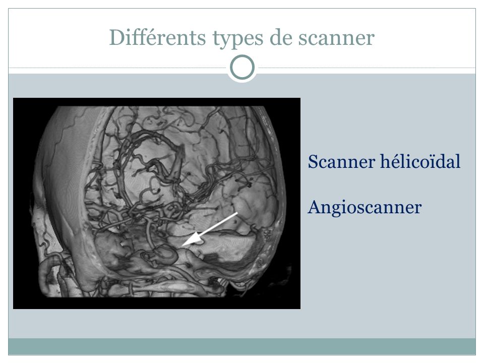 Différents types de scanner