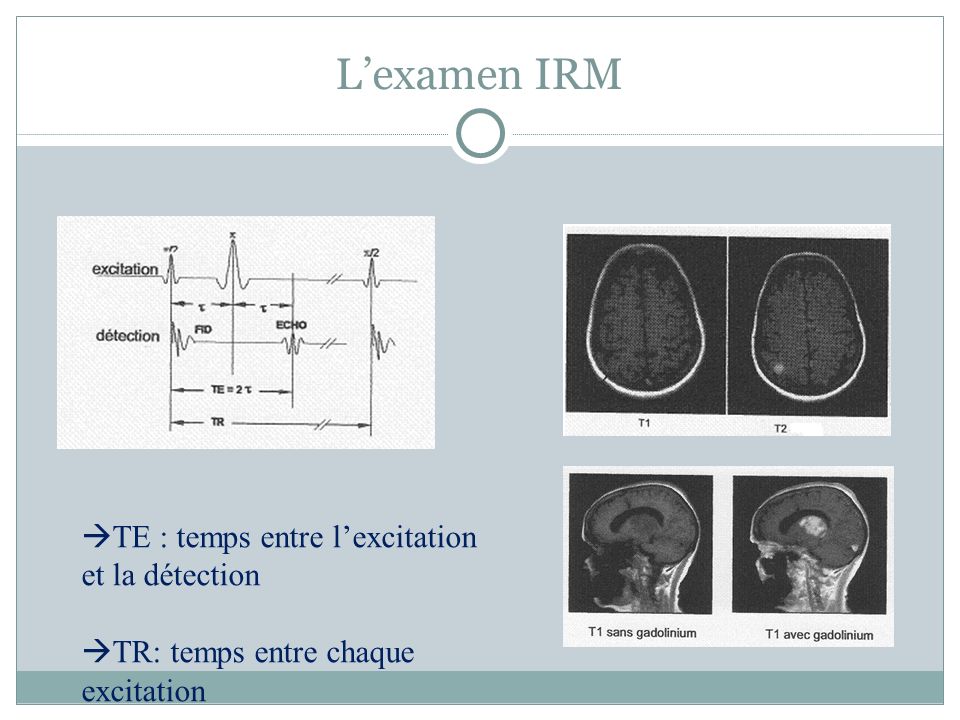 L’examen IRM TE : temps entre l’excitation et la détection