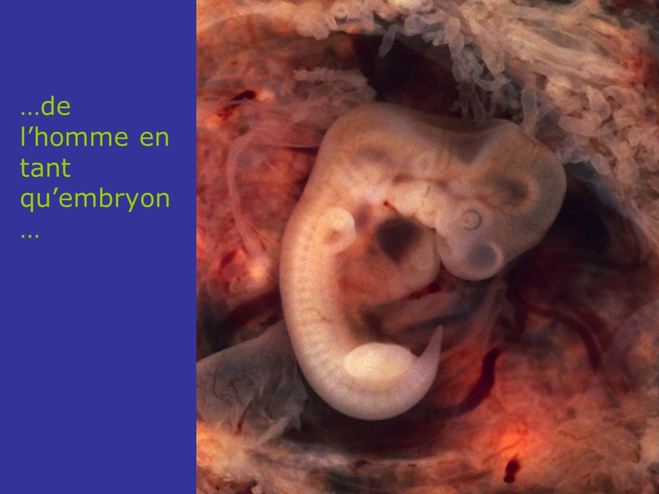 …de l’homme en tant qu’embryon…