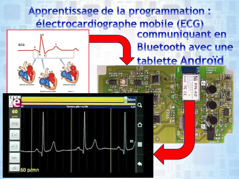 Apprentissage de la programmation : électrocardiographe mobile (ECG)